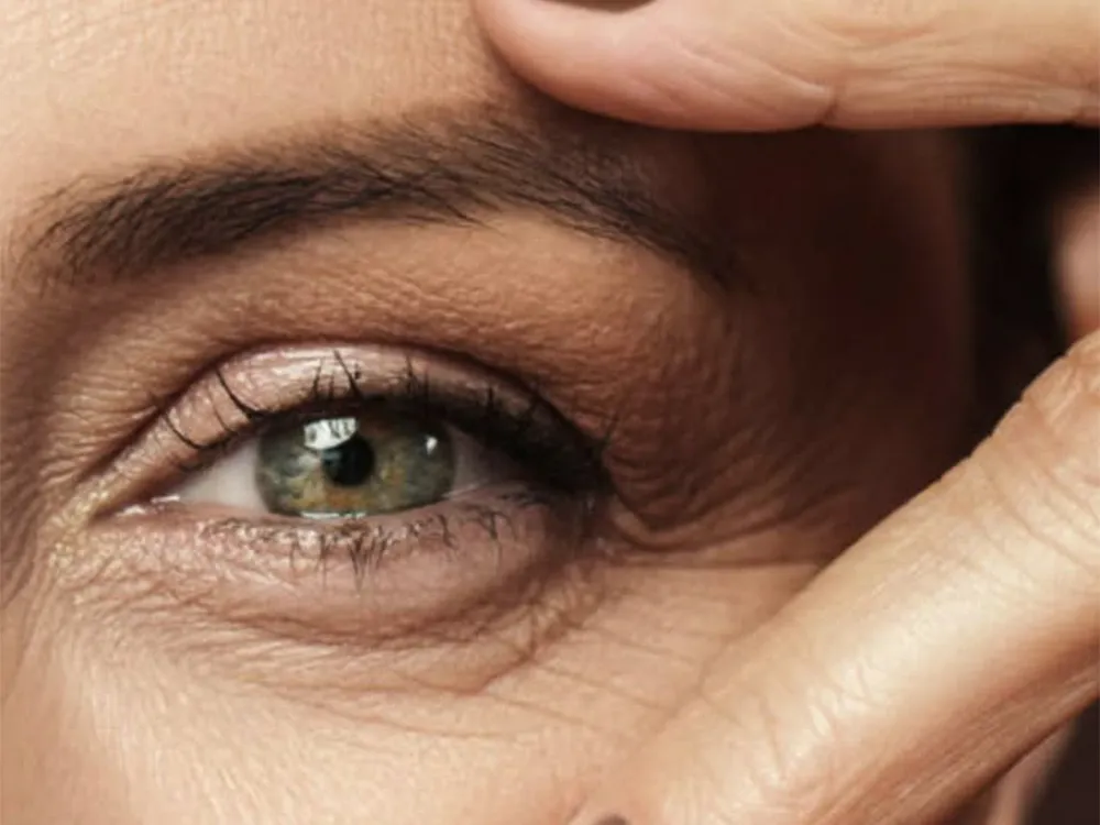 کرم ضد چروک