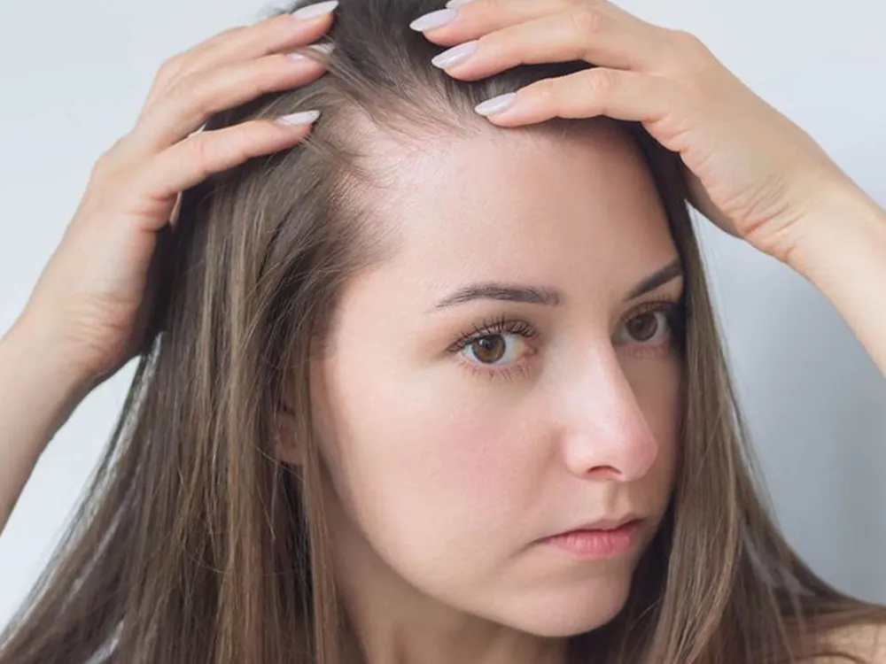 شامپو ضد ریزش مو